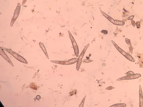 Demodex,Mange,From,A,Microscope,View.